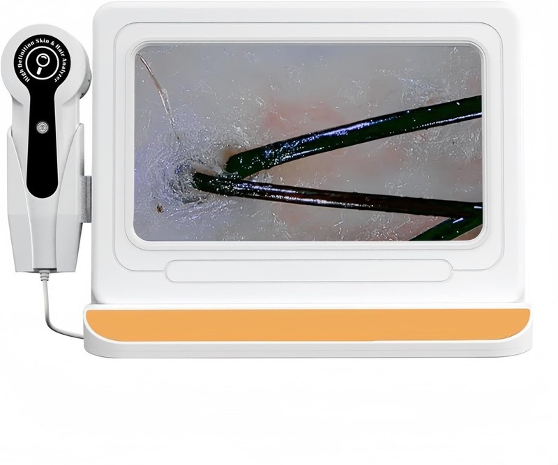 Professional Scalp Camera with 11-Inch HD Screen - High-Definition Hair & Sca... gallery